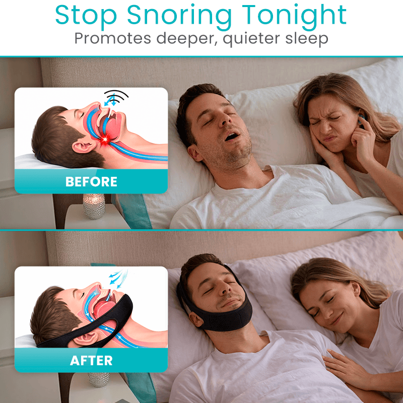 Anti-Snoring Chin Strap
